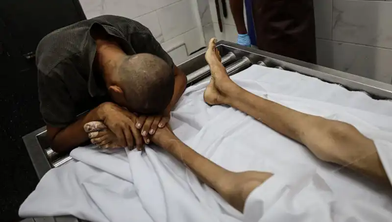 Gazze'de Acı Bir Kaybı Daha Yaşandı: Bir Çocuk Açlıktan Hayatını Kaybetti