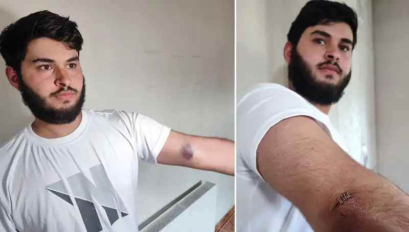 Mahallede Bahçeye Kaçan Top, Eğlenceli Bir Kargaşa Yarattı!